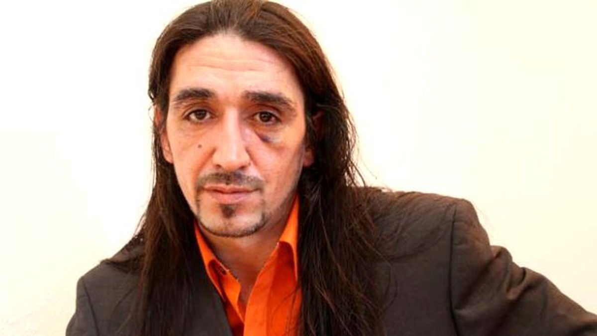 Almanya'da PKK'lıların Saldırısına Uğrayan Türk: Polis Bana Değil Onlara Yardım Etti