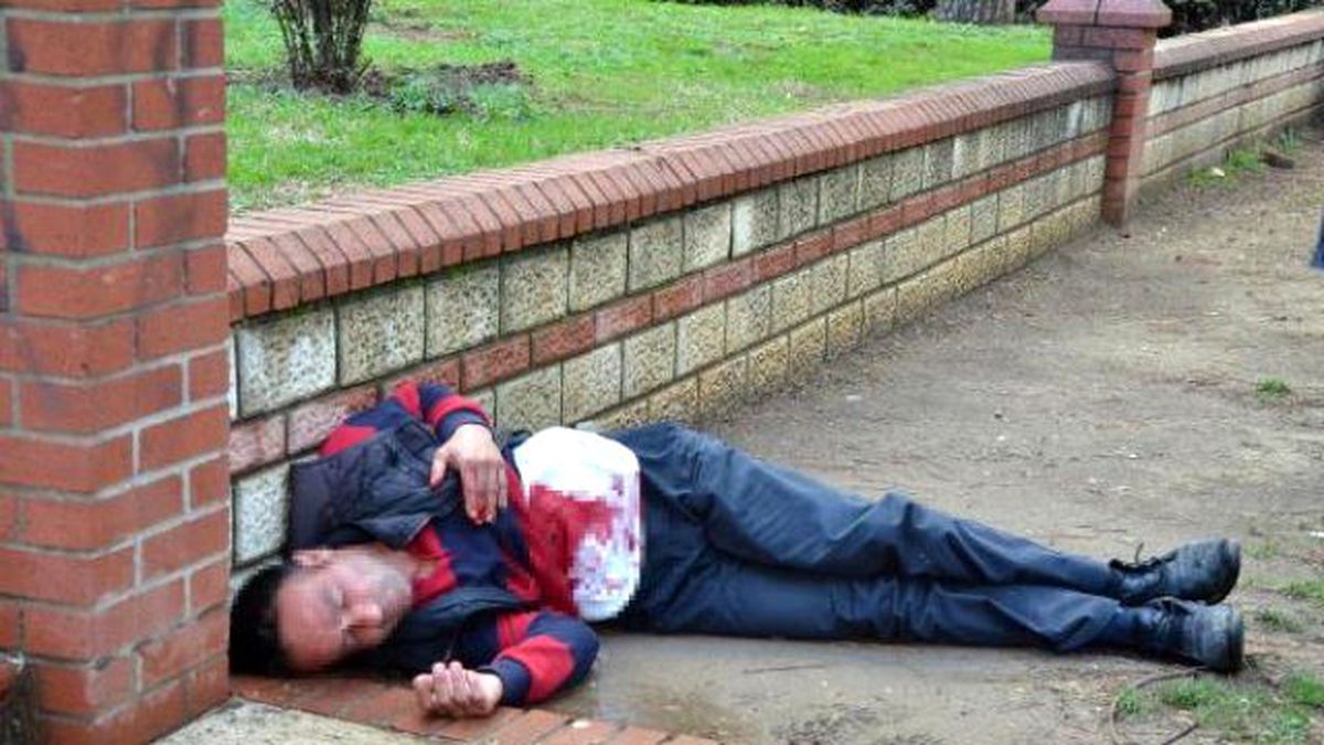 Psikolojik Sorunları Bulunan Adam, Ağabeyiyle Tartışıp Kendini Yaraladı