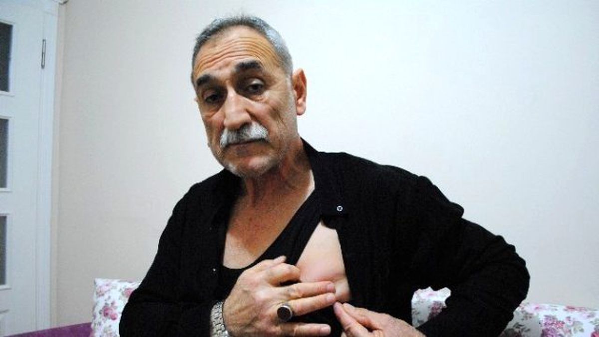Kalbinin Üstüne Saplanan Keneyle Bir Yıl Yaşadı