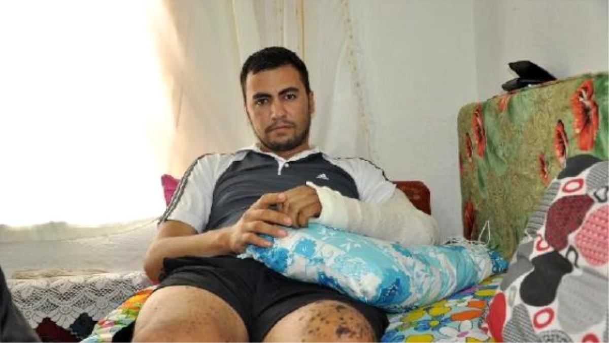 Yaralı Komutanına Yardım Etmek İsterken El Bombasıyla Yaralandı
