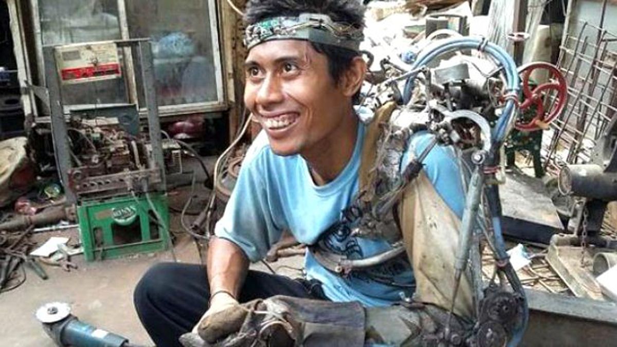 Felçli İşçi Hurdalardan Kendisine Biyonik Kol Yaptı