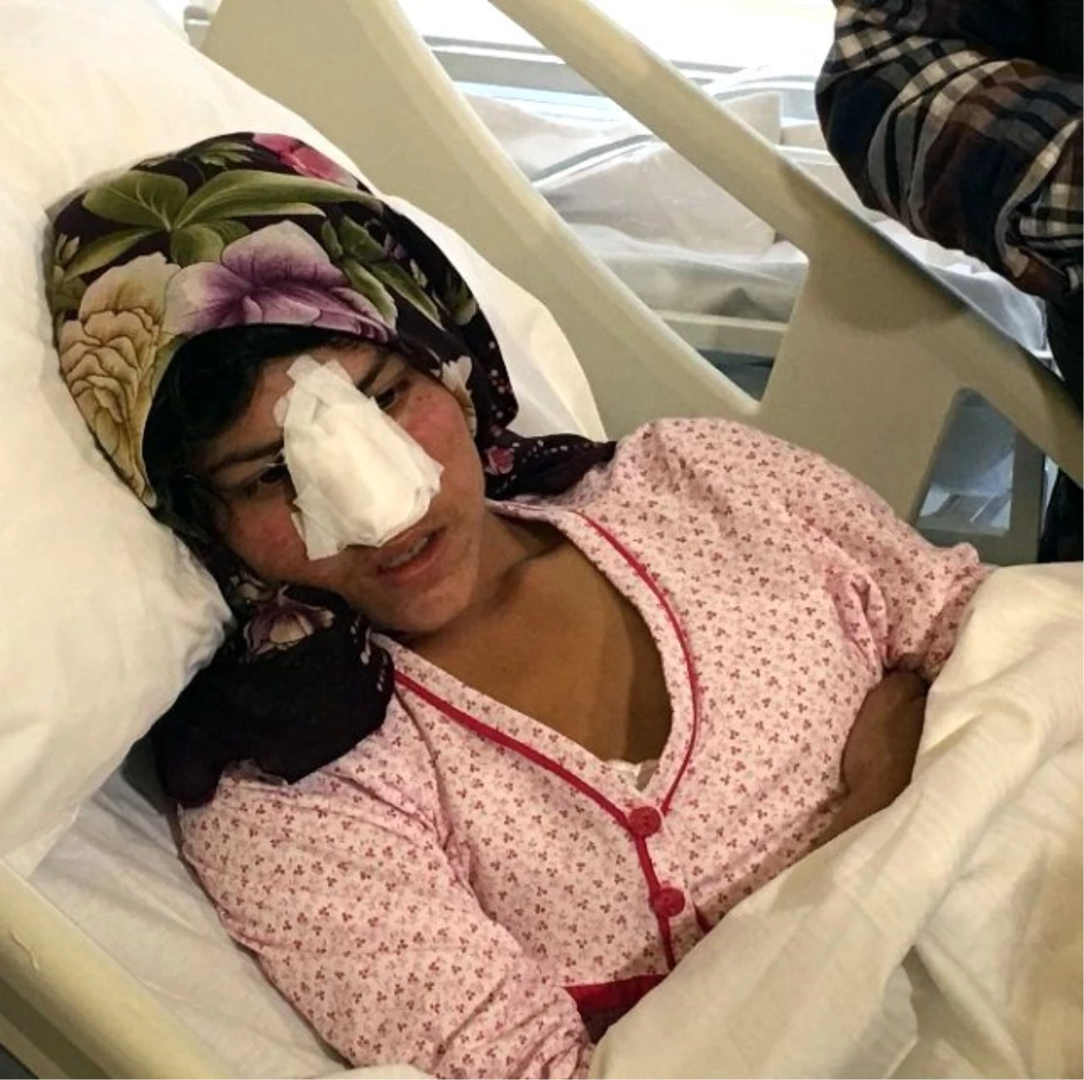 Burnu Kesilen Afgan Kadın Ankara\'ya Getirildi