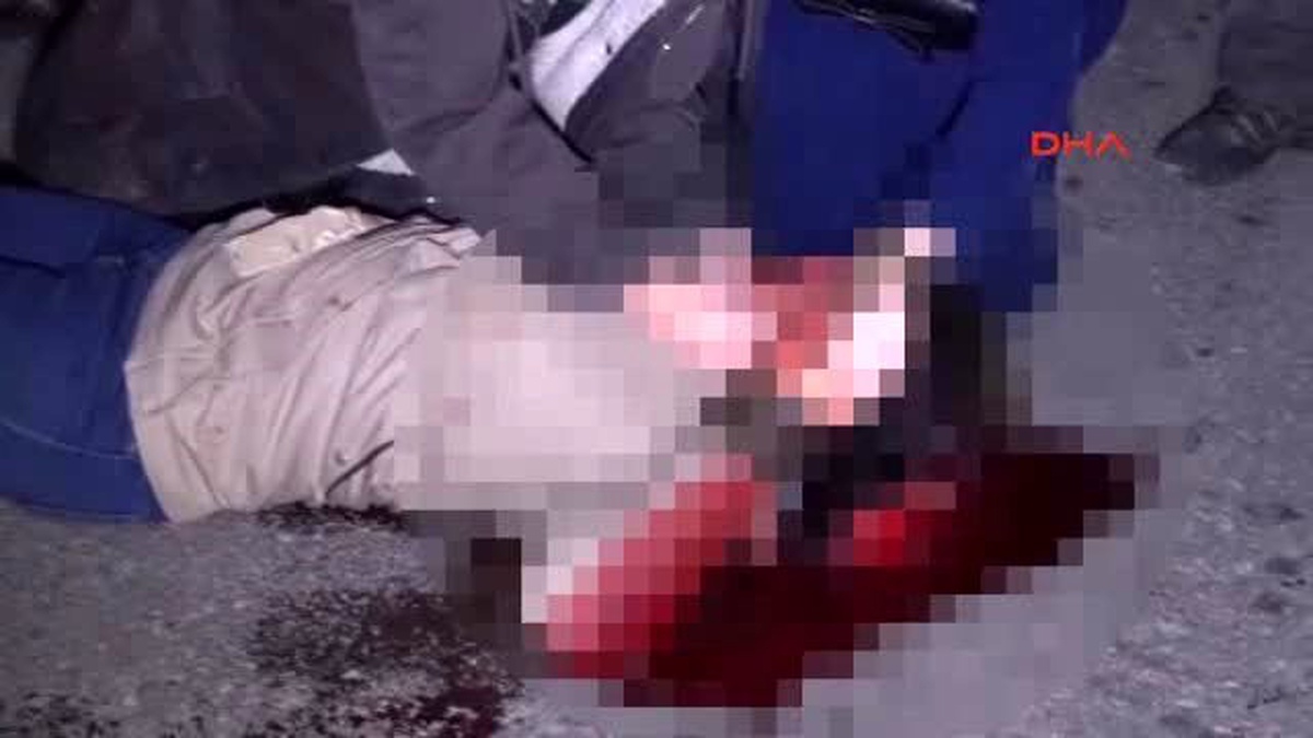 Zonguldak\'ta Halk Otobüsünün Çarptığı Genç Kız Ağır Yaralandı