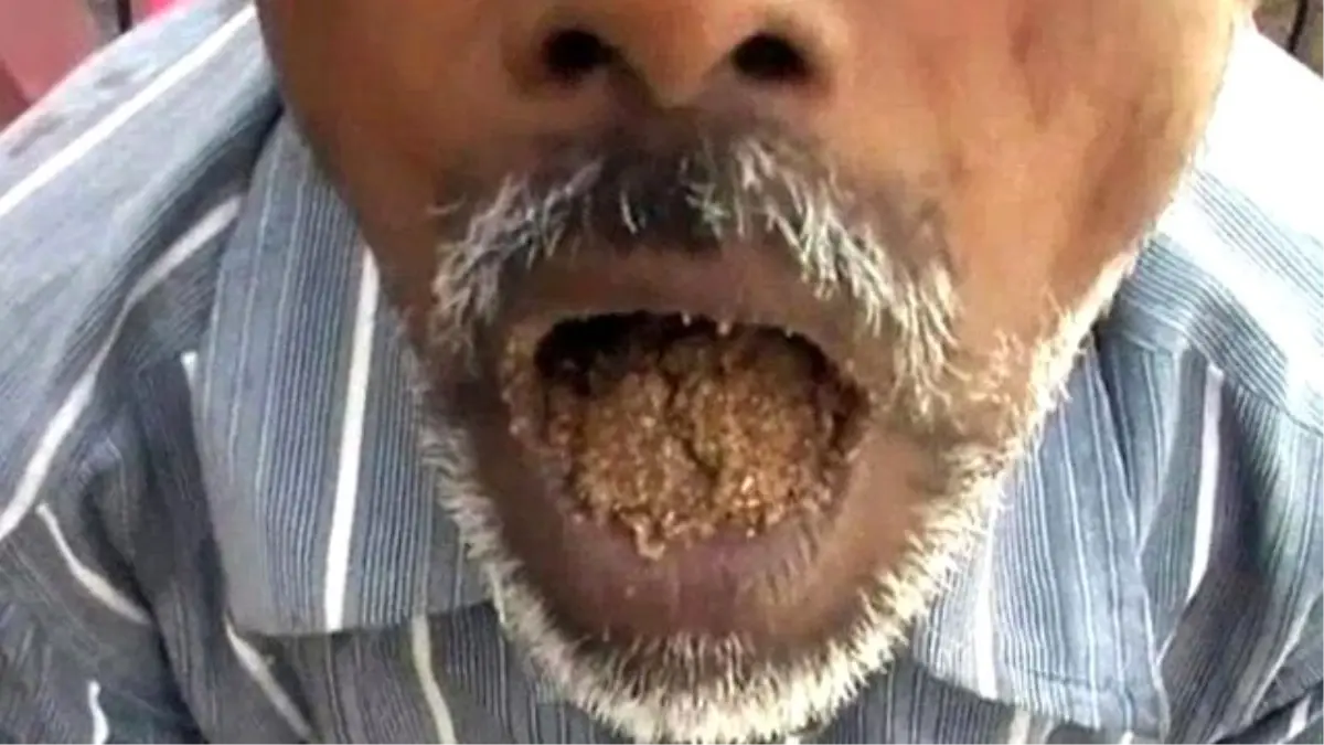 Taş, Kum, Çakıl Yemeden Duramıyor