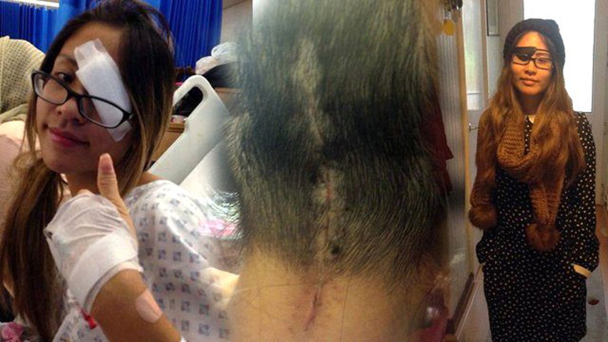 Hamile Olduğunu Düşünen Genç Kızın Beyninde Tümör Çıktı