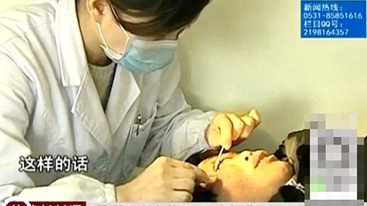 Kocası Çinli Kadının Gözünden Taş Çıkarttı, Doktorlar İnanmadı