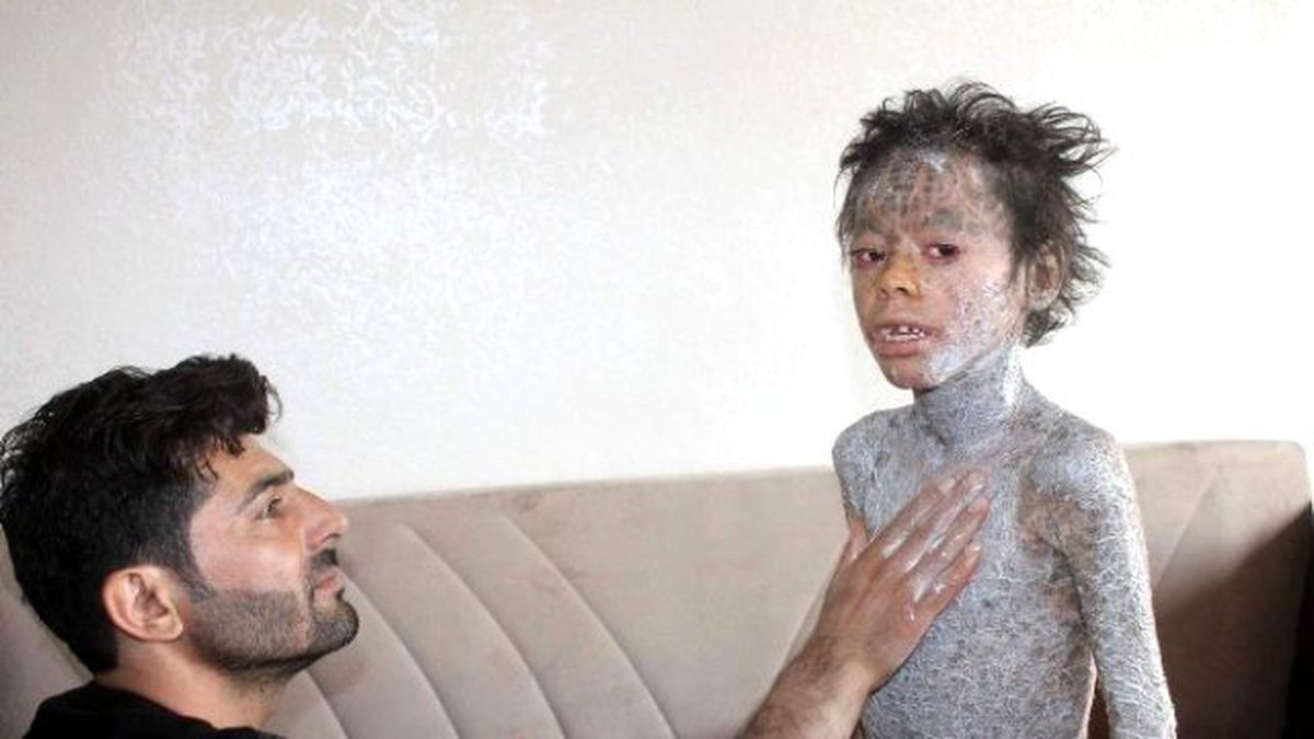 Küçük Melih'in Dramı Yürek Burkuyor: Herkes Benden Korkuyor!