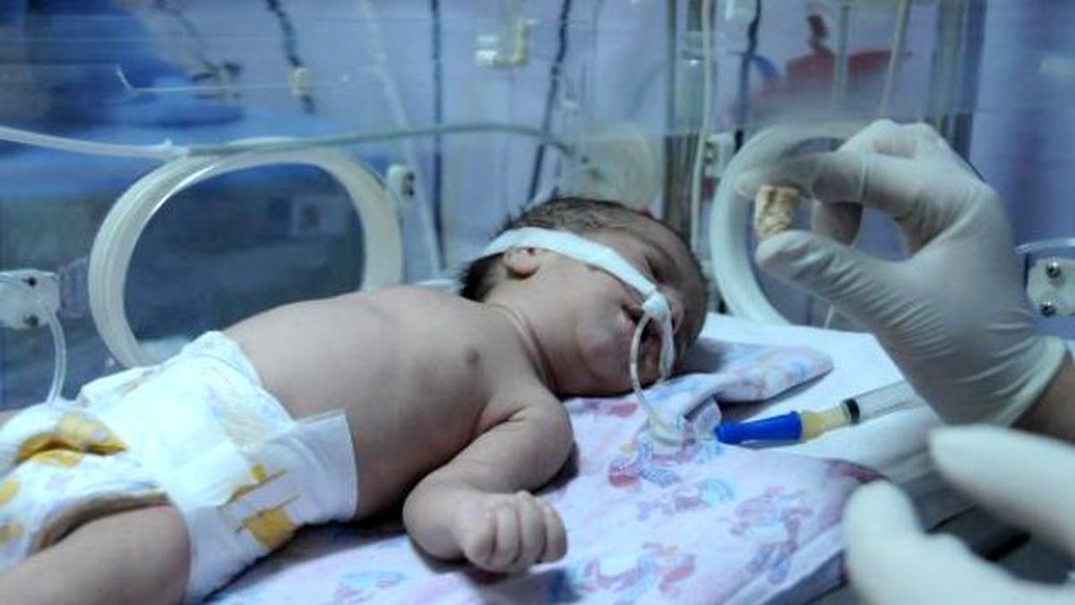 3 Günlük Bebeğin Yemek Borusundan Taş Çıktı