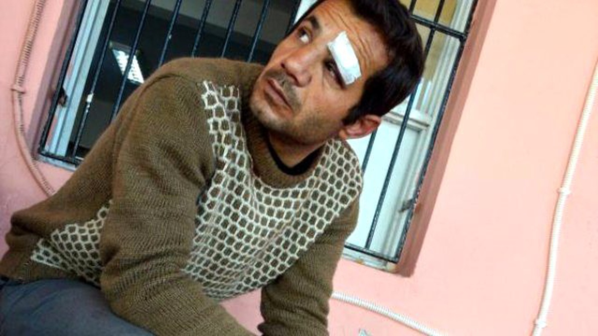 Hurdacı, İşyerinde Yakaladığı Hırsızı Hastanelik Etti