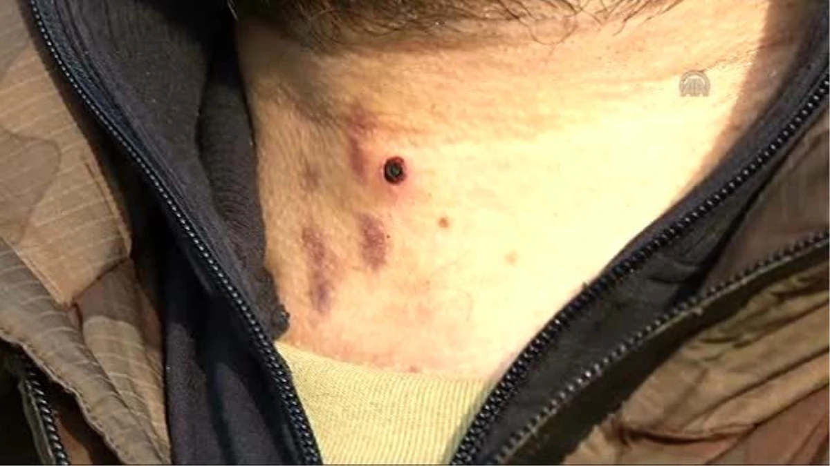 Boynundan Yaralanan "Özel Harekatçı" Eve Dönmeyi Kabul Etmedi