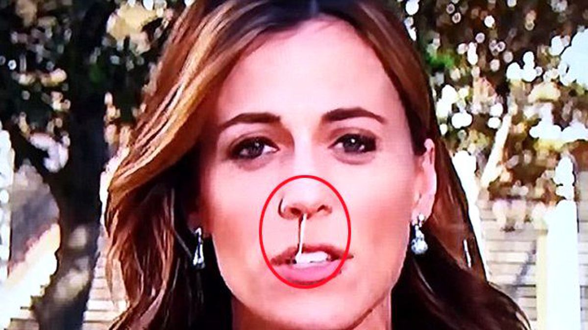 Canlı Yayında Sümüğü Akan Muhabirin Zor Anları