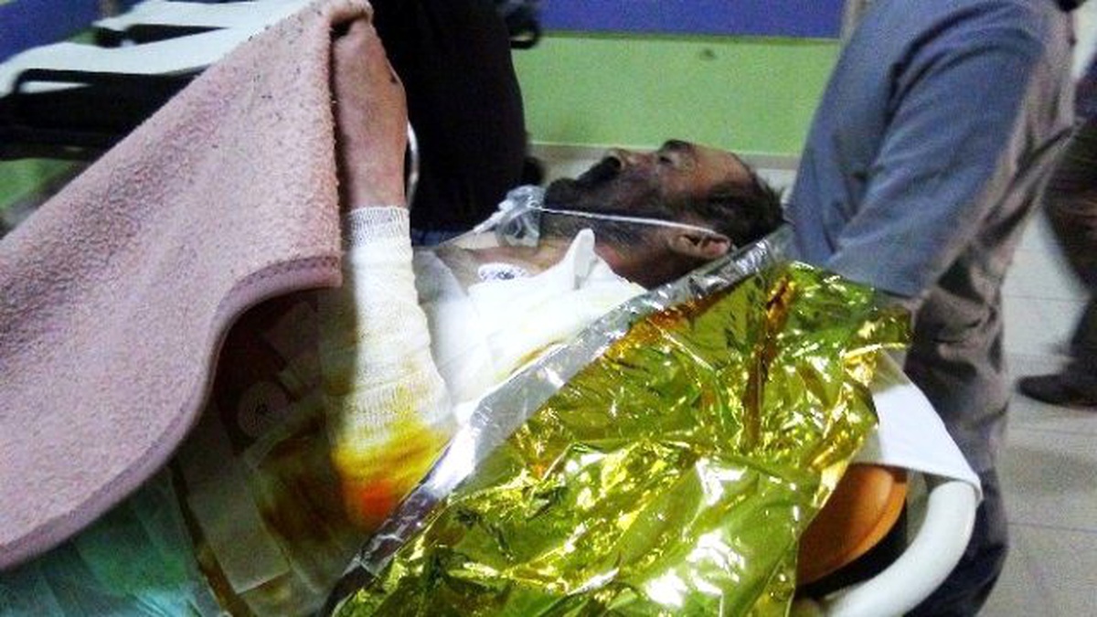 Yangına Uykusunda Yakalandı, Yanarak Yaralandı