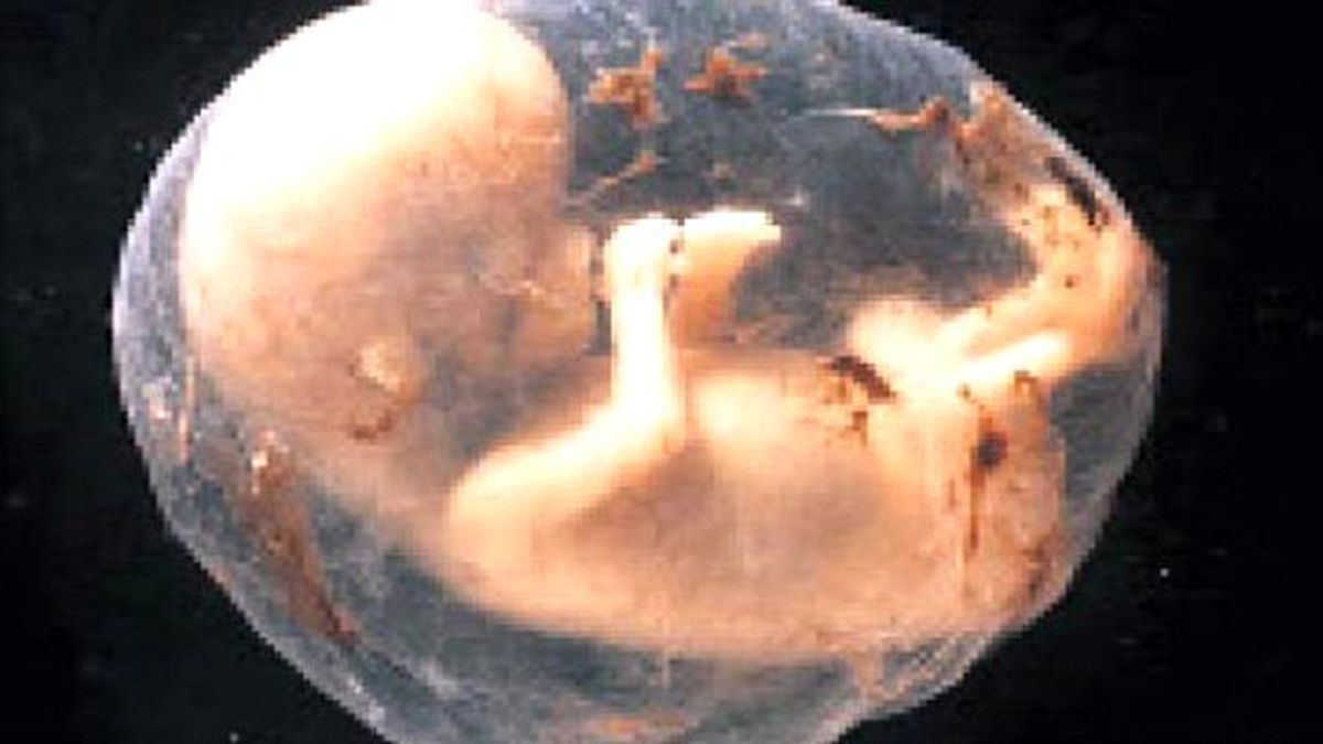 Anneye Korkunç Teklif: Bebeğini Aldırma, Doğunca Yedek Parça Yapacağız