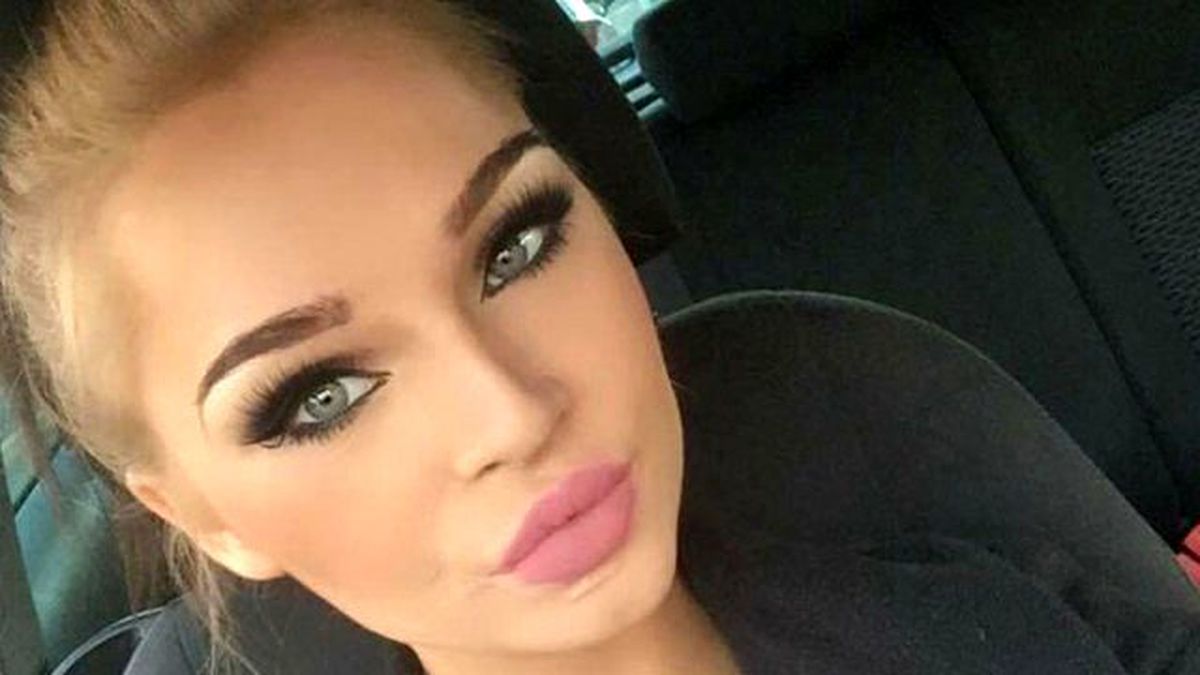 Trafik Kazasında Yüzü Parçalanan Genç Kızın Görüntüsü Şaşırttı