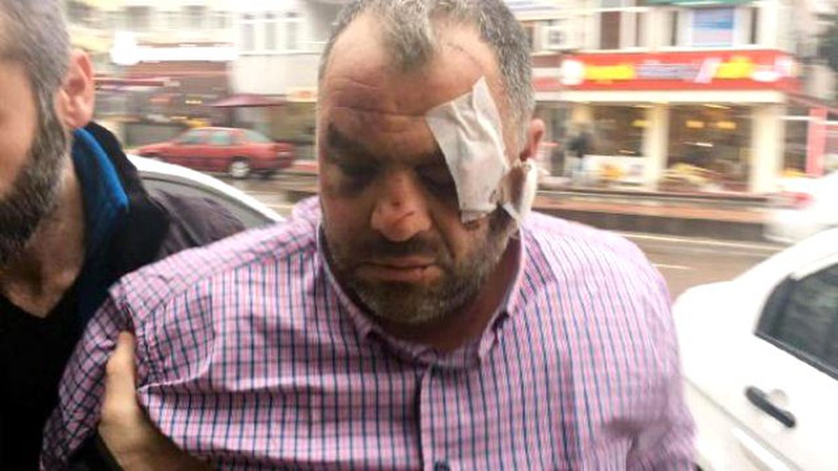 Çay Ocağının Önüne Park Eden Gençleri Bıçaklayan Çaycı Tutuklandı