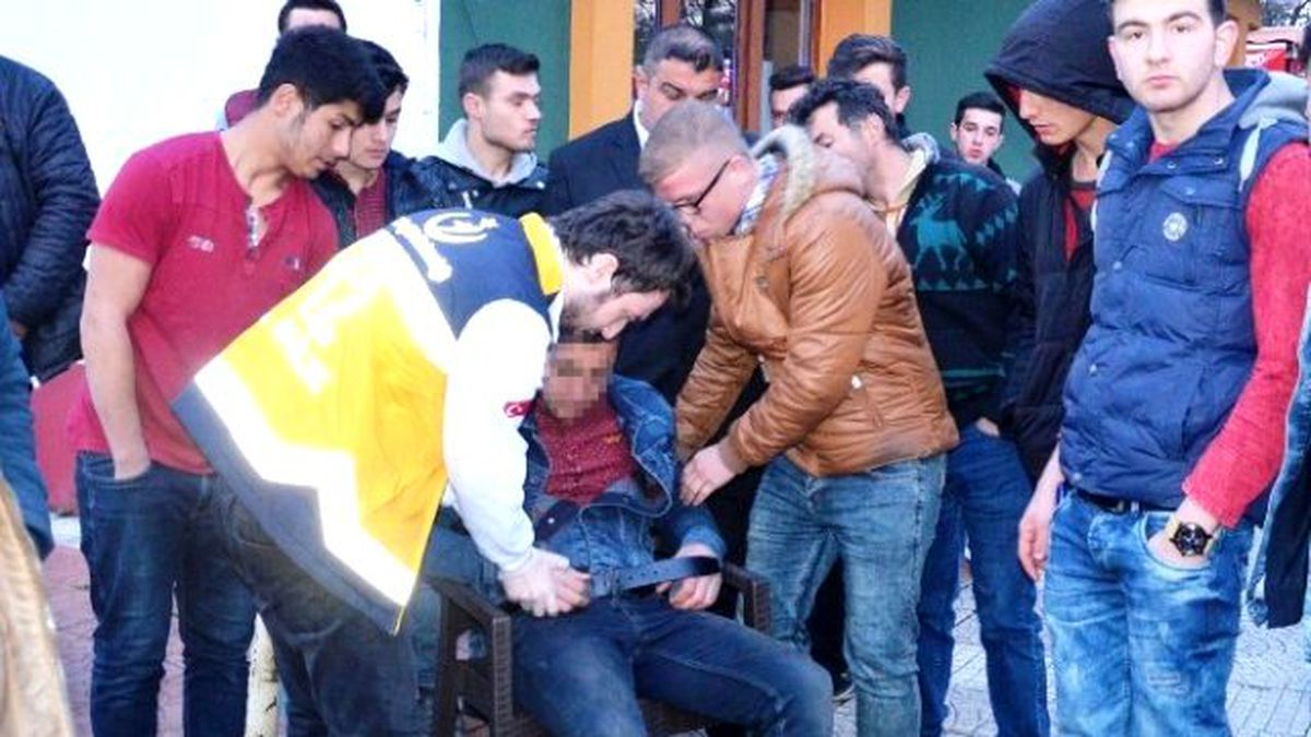 Havalı Tüfekle Oynarken Arkadaşını Yaraladı