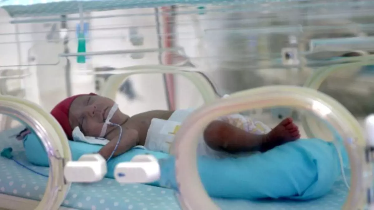 Bursalı Beşizler 1 Aylık Oldu