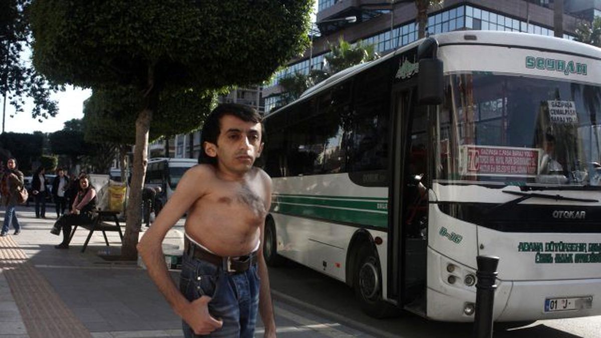 Engellinin İsyanı! Otobüs Durağında Soyundu