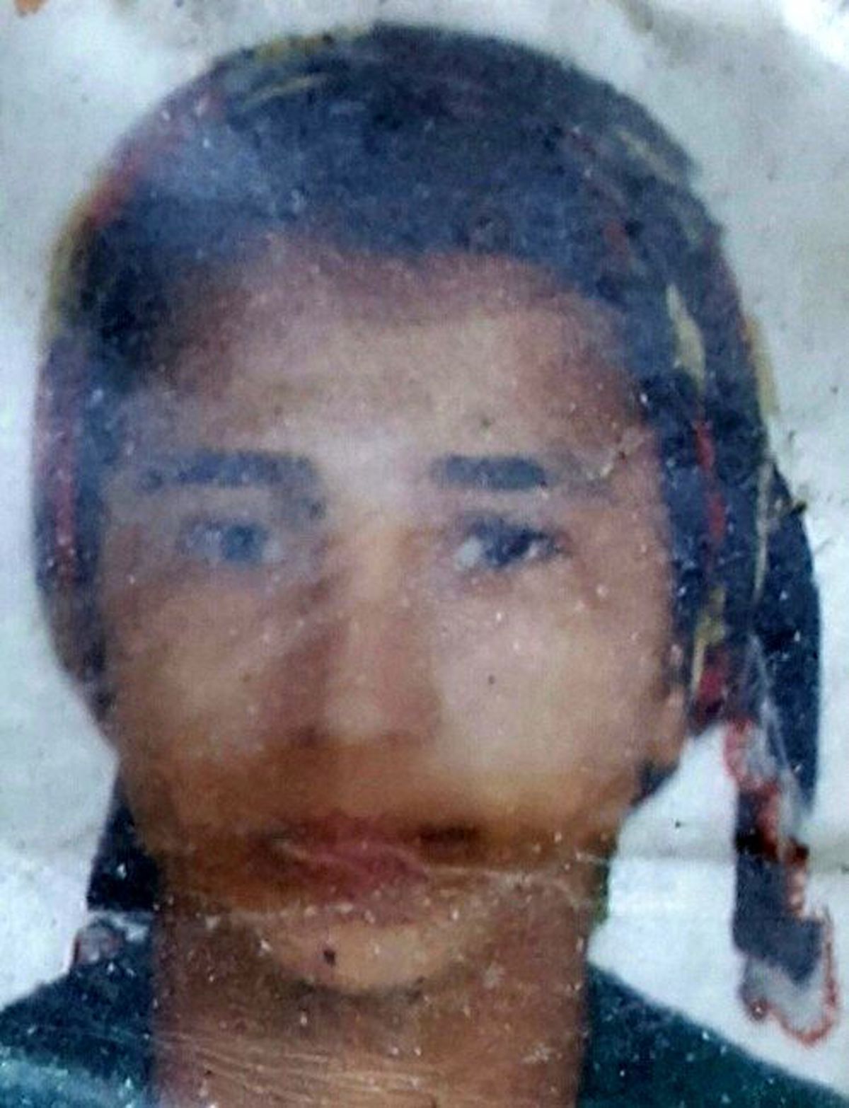 Kazada Ağır Yaralanan Genç Kadın Öldü
