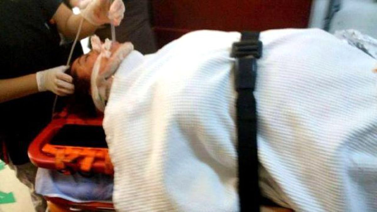 Halı Silkelerken Balkondan Düşen Kadın Ağır Yaralandı