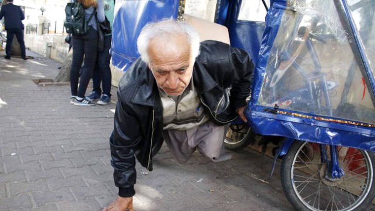 Yanlış Tedavi Sonucu Hayatı Kararan Adamın Mücadelesi Takdir Topluyor