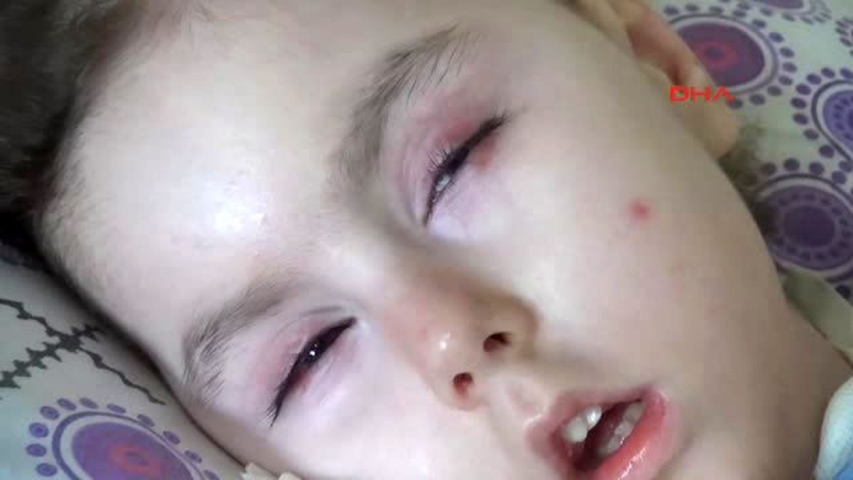 Minik Ecrin'in Nefes Alabilmesi İçin Her Ay 4 Bin Lira Gerekiyor