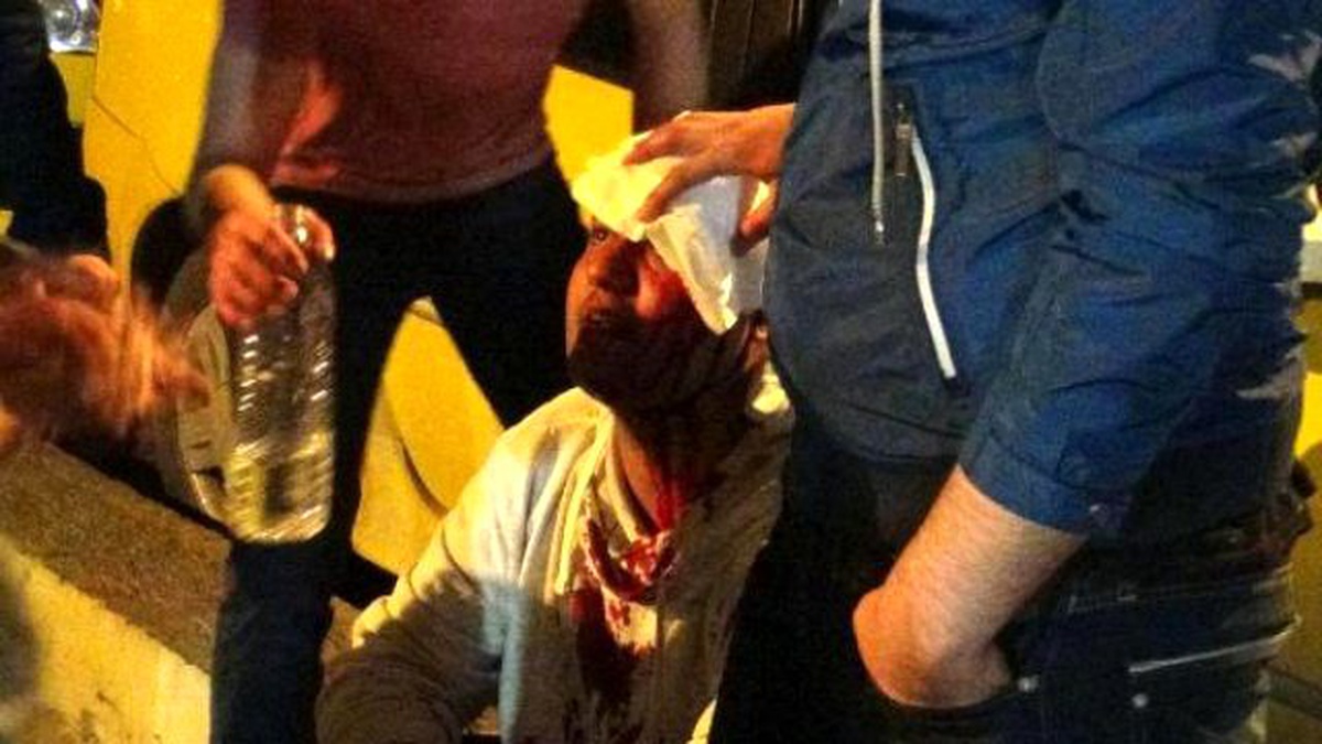 Gençler Arasında Laf Atma Kavgası: 1 Yaralı