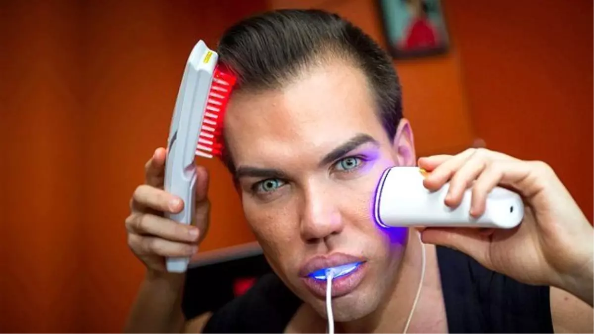 Barbie Adam\'ın Estetik Yüzünden Burnu Çürüdü