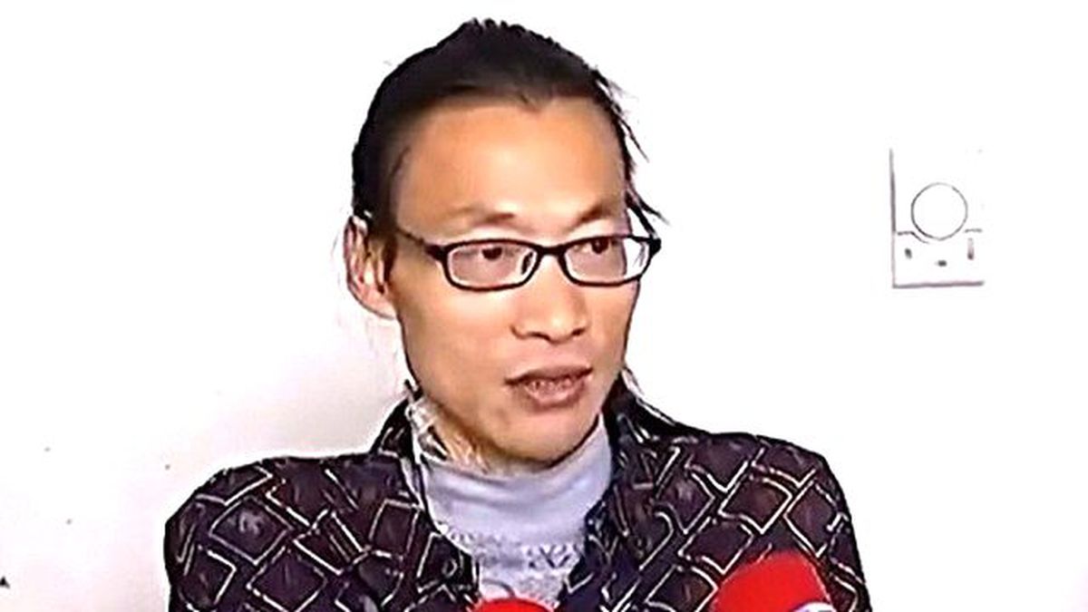 Çinli Adamın Karnından 31 Kiloluk Tümör Çıktı