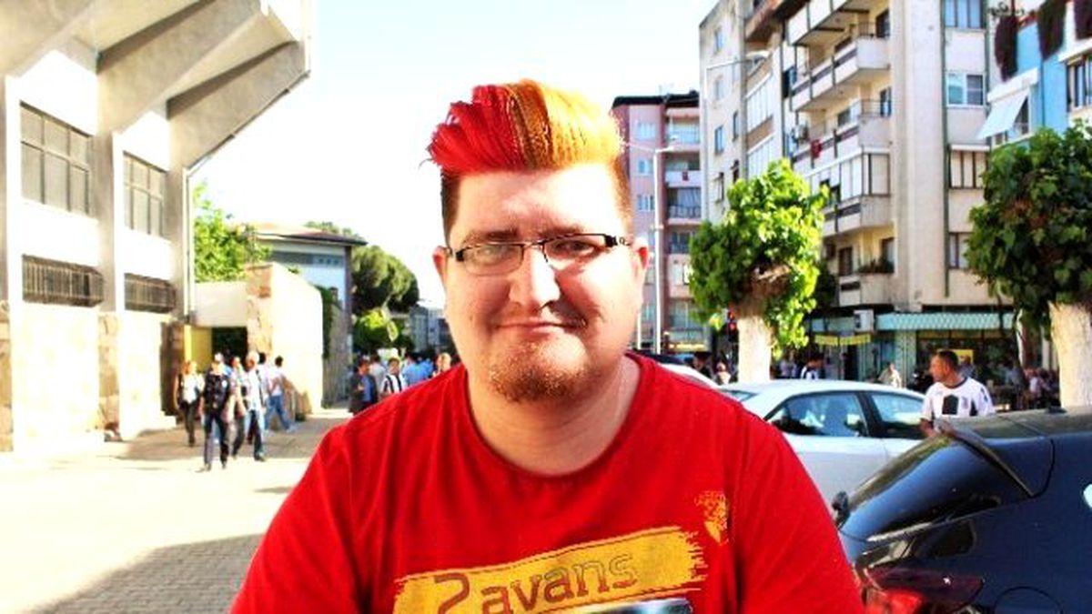 Takımı İçin Saçlarını Boyattı