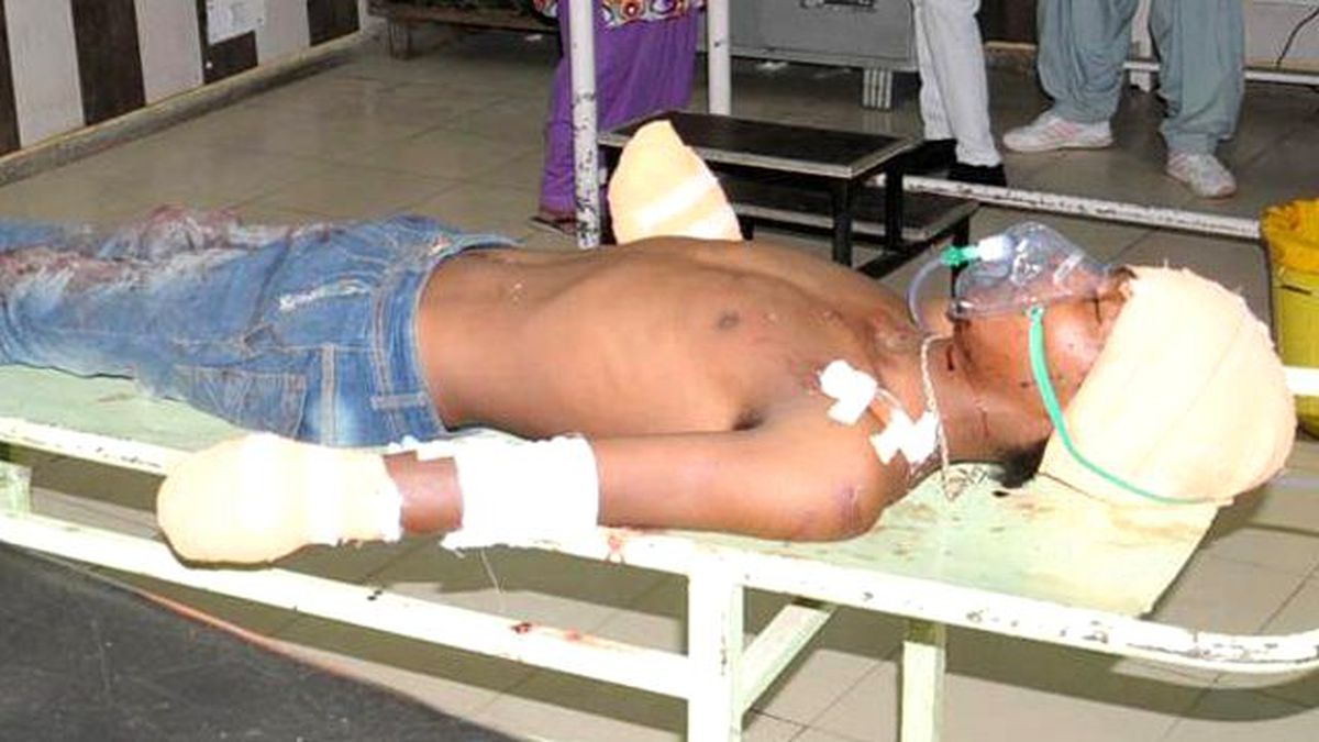 Baba, 8 Aylık Bebeğine Tecavüz Eden Gencin Ellerini Kesti