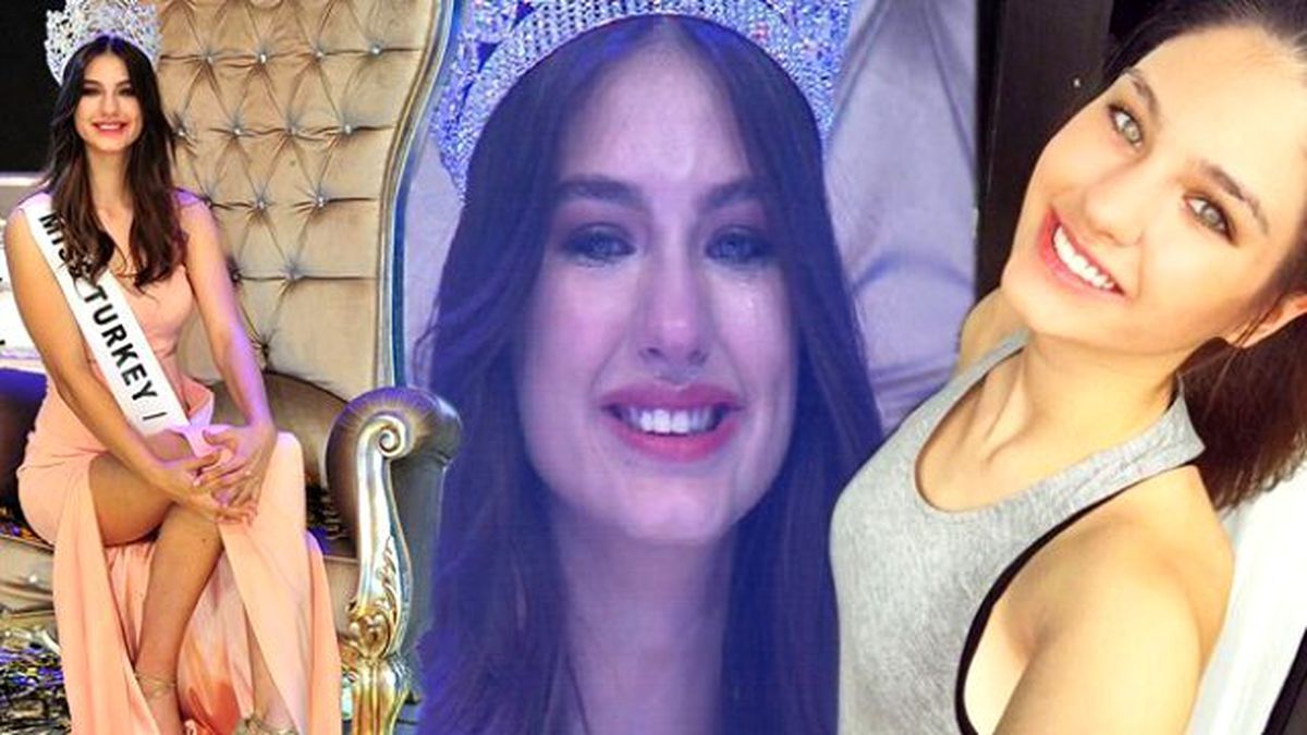 Eleştirilere Dayanamayan Türkiye Güzeli Ecem Çırpan, Soluğu Dişçide Aldı