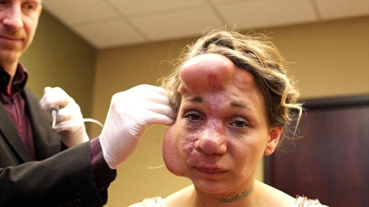 Atardamarlarındaki Bozukluk Genç Kadının Hayatını Kararttı