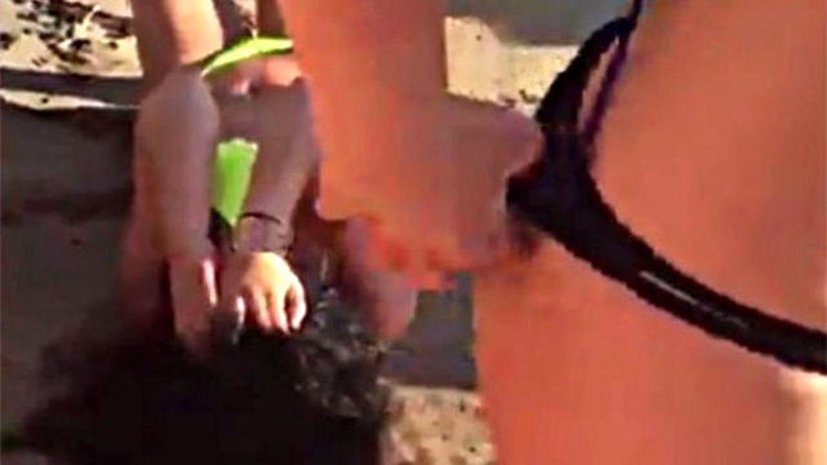 Güneşlenen Kadına Lise Arkadaşları Saldırdı