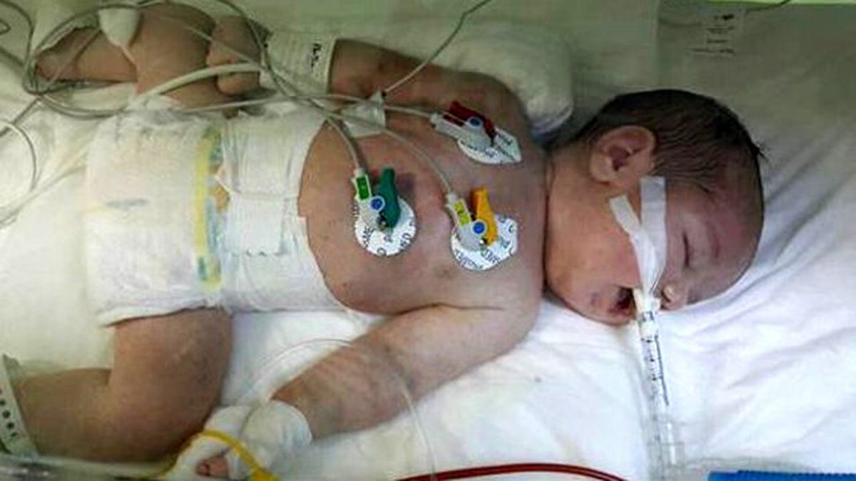 Ebe, Doktor Gelmeyince Bebeği Rahme Geri İtti!