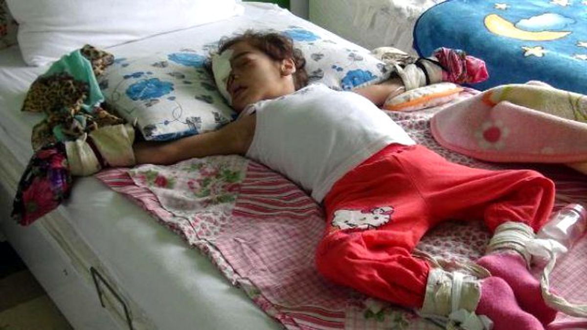Acıyı Hissetmediği İçin Dişlerini Söken ve Burnunu Parçalayan Bebek Öldü