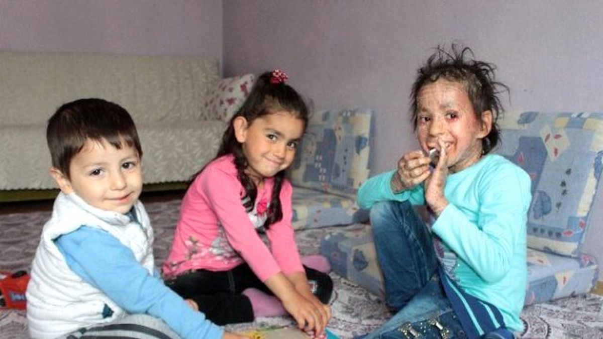 6 Yaşındaki Azra'nın Derisi, Balık Pulu Gibi Dökülüyor