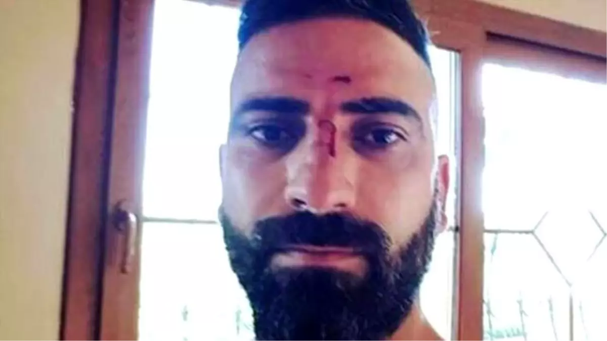 Dünya Şampiyonu Boksör, Kendisine Saldıran 8 Kişiyi Hastanelik Etti