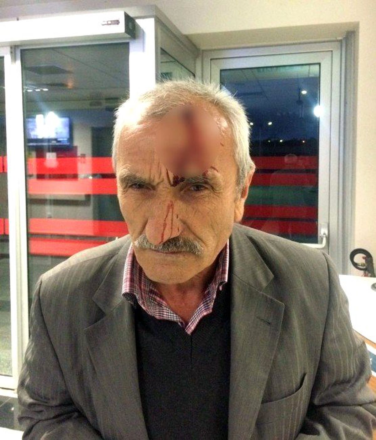 Yeğeni, Ağaçtan Erik Alan Amcasını Baltayla Yaraladı
