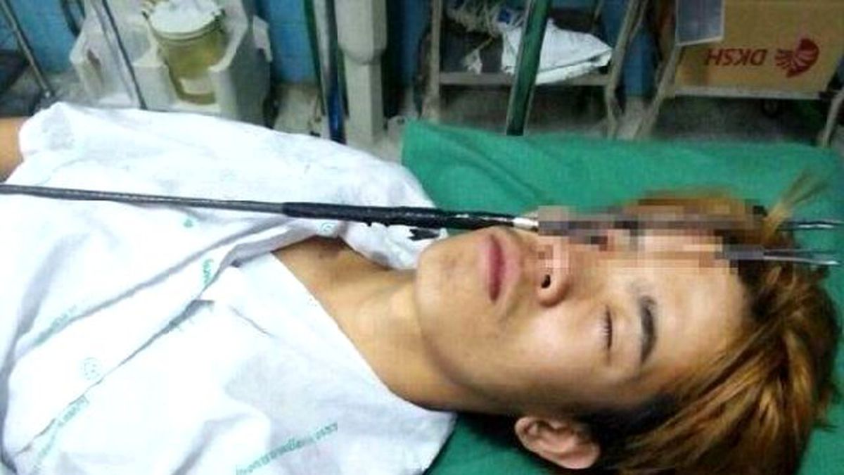 Taylandlı Genç, Zıpkınla Kendini Gözünden Vurdu!