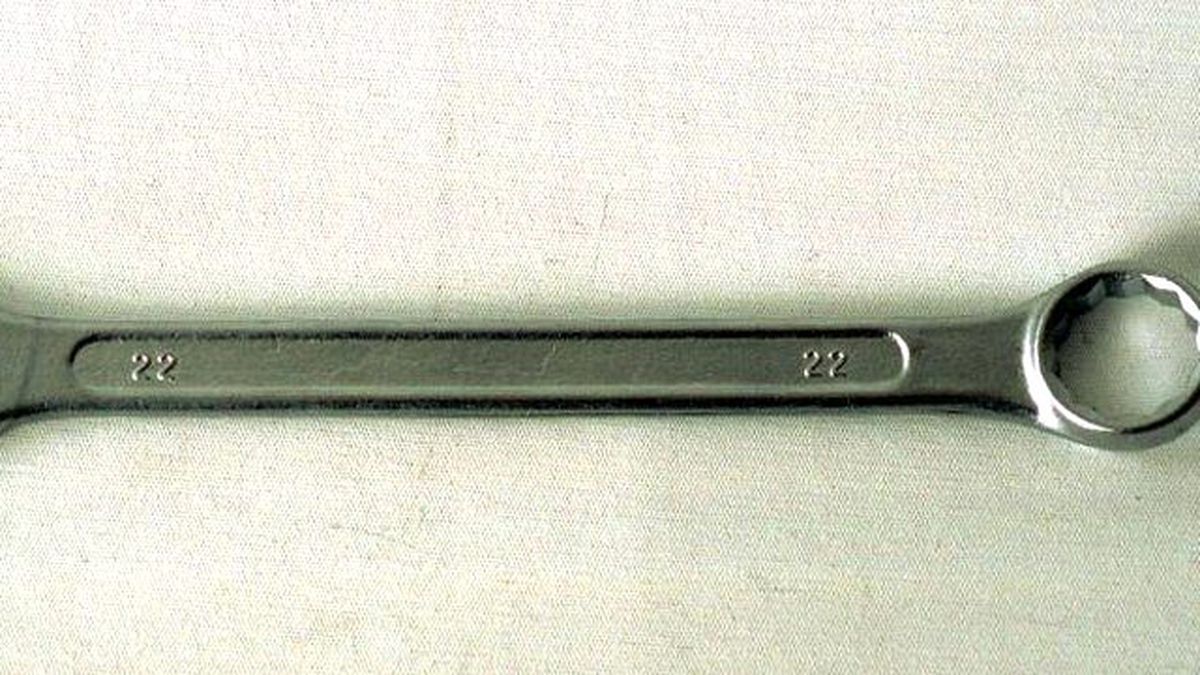 Cinsel Organını Yıldız Anahtarına Sıkıştıran Adamı İtfaiye Kurtardı