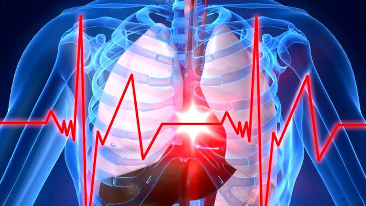 Aort damarı neden yırtılır?