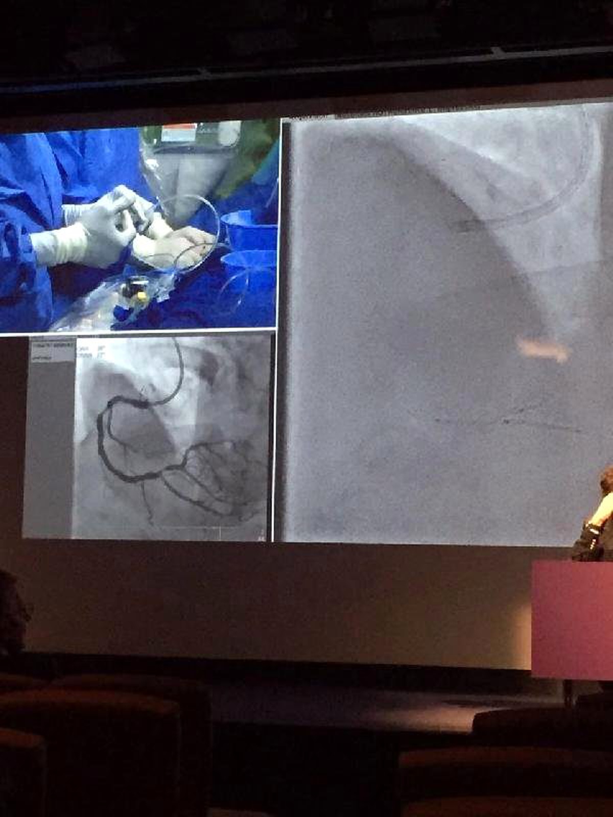 Paris Europcr\'da Alvimedica\'ya Büyük İlgi