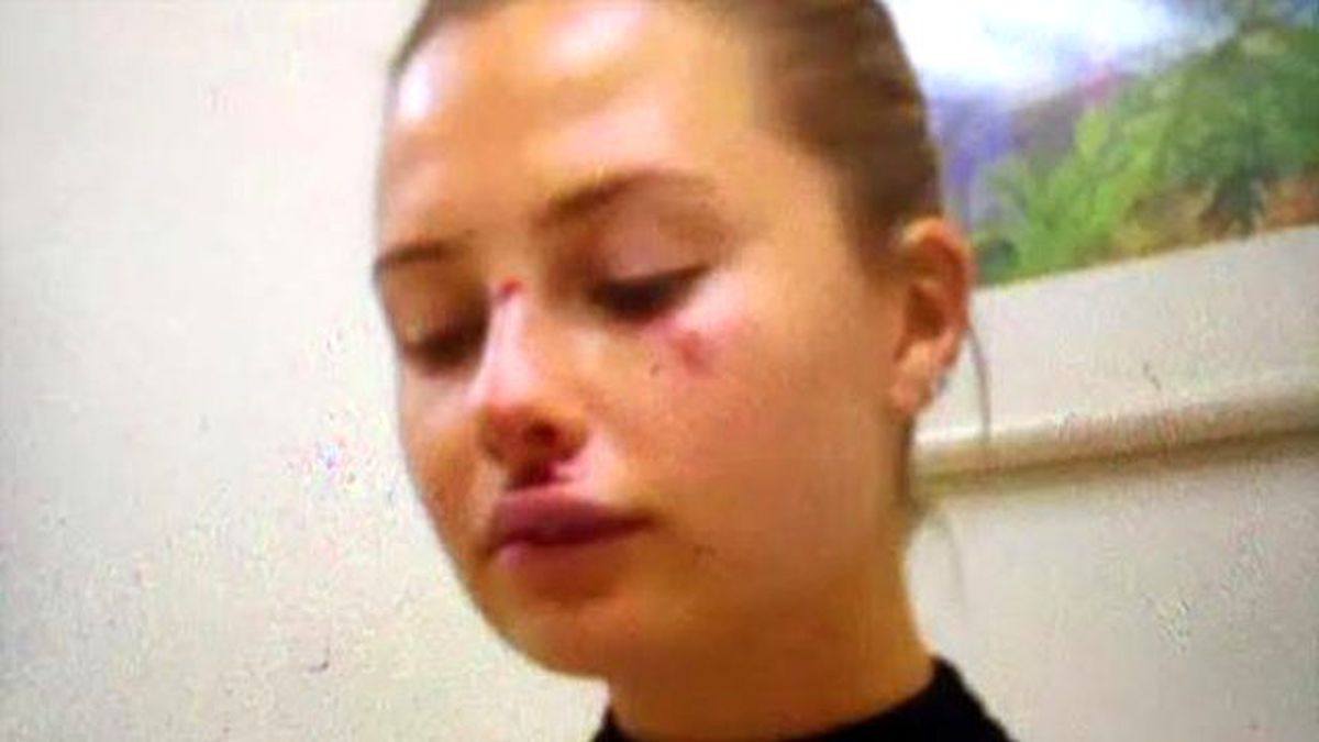 Kaza Geçiren Serdar Ortaç'ın Eşinin Yüzü, Çizik İçinde Kaldı