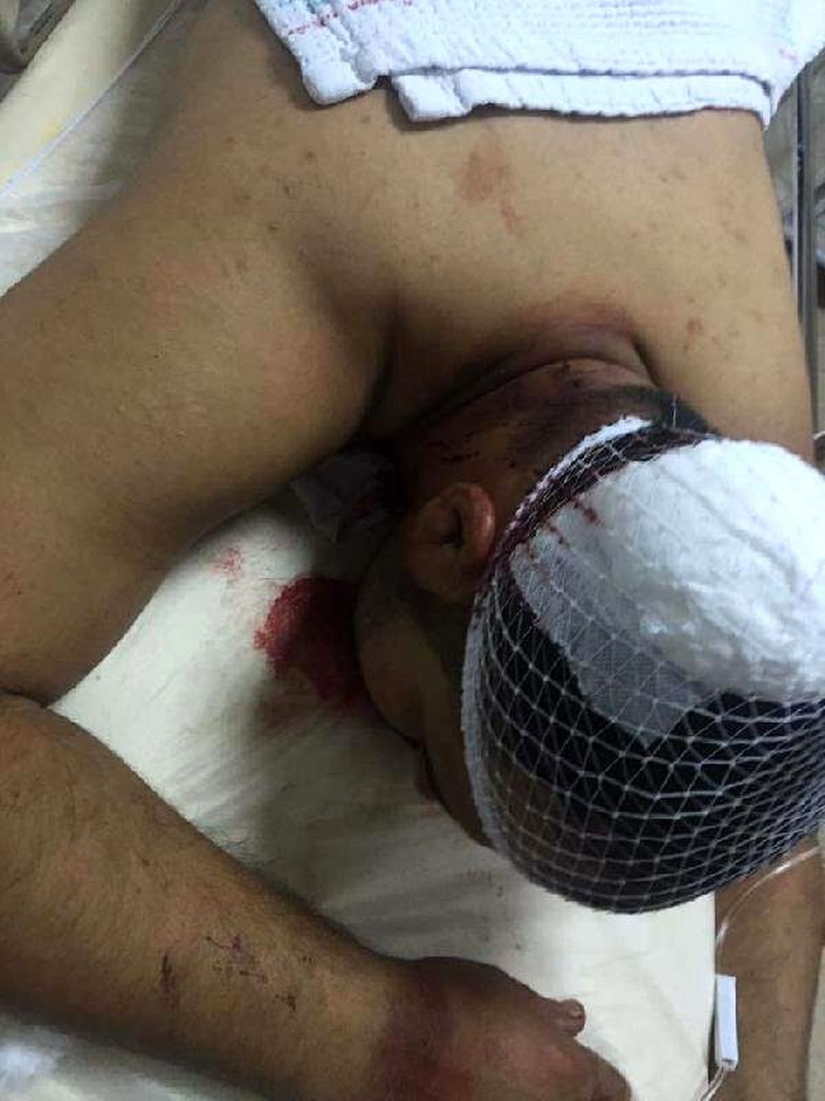 Dur\' İhtarına Uymayan Sürücüyü Jandarma Başından Vurup, Yaraladı