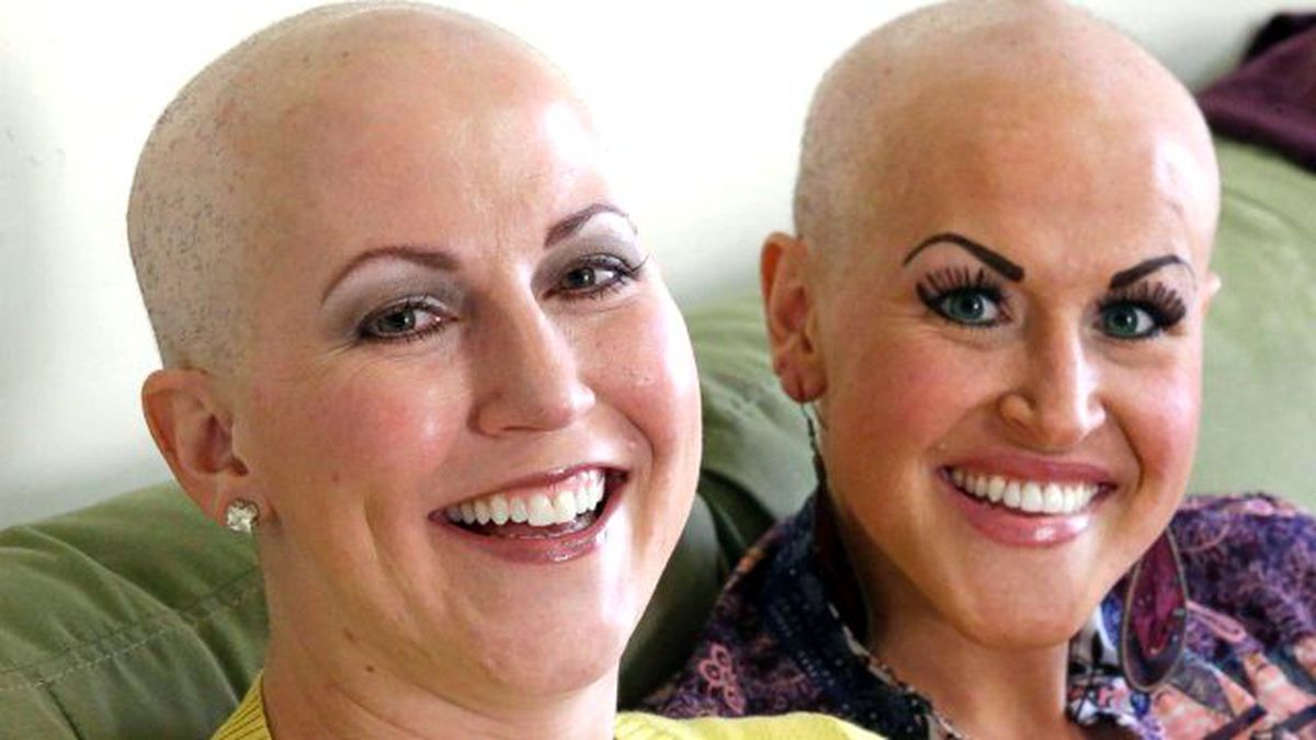 İki Kız Kardeş 14 Gün Arayla Kanser Oldu