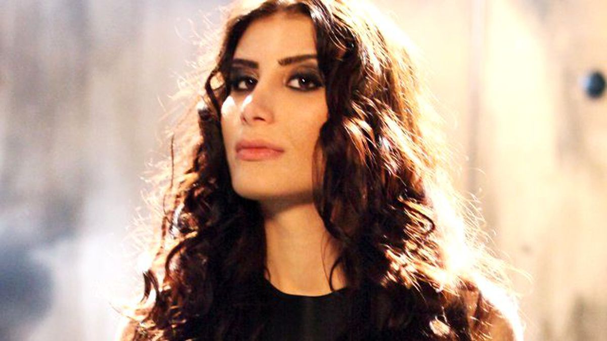 İrem Derici'nin Arabasına Kuş Pisledi, Ortaya Çıkan Şekil Şaşırttı