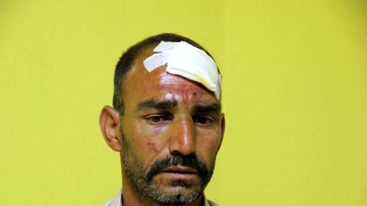 Kahveye Selam Vermeden Girince Dayak Yedi