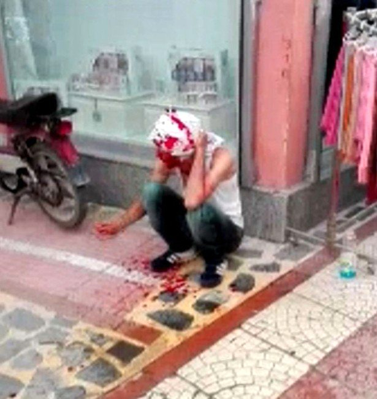 Kardeş Davulcuların Yer Kavgası Kanlı Bitti