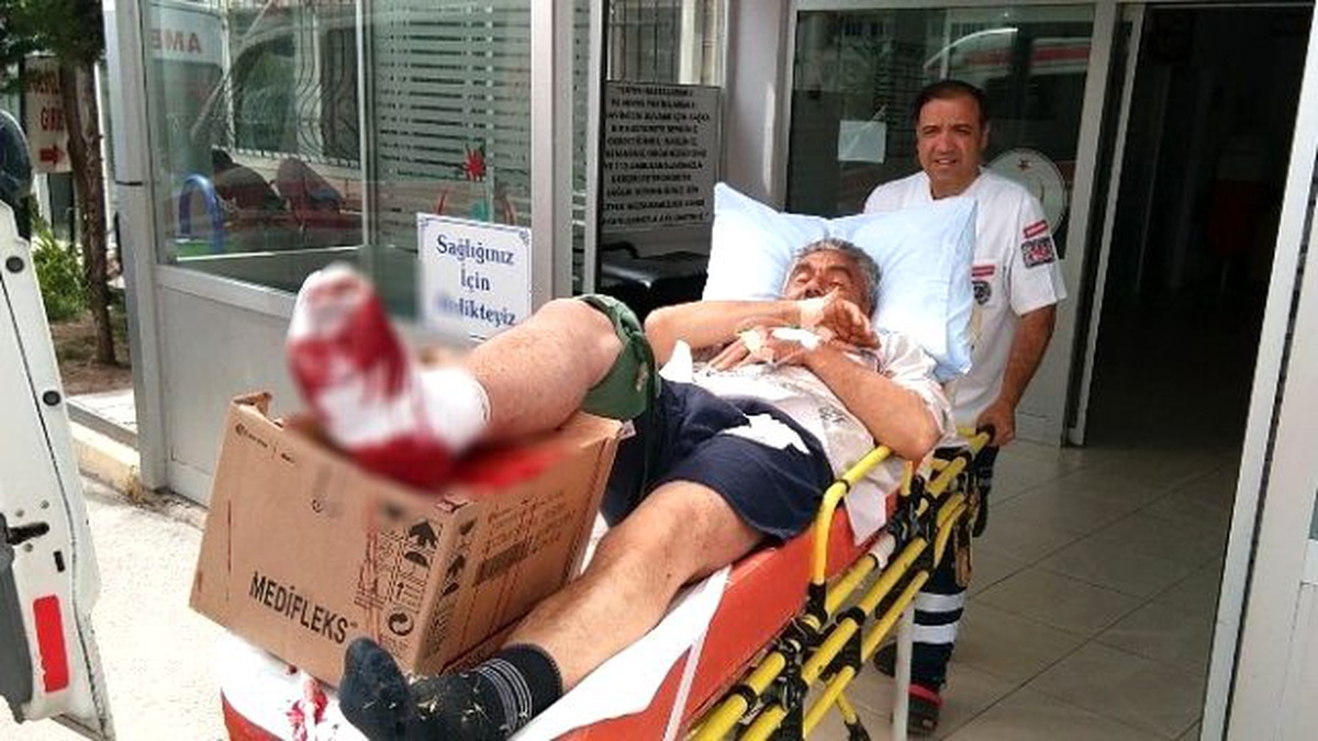 Otları Kesmek İsterken Ayağını Kesti